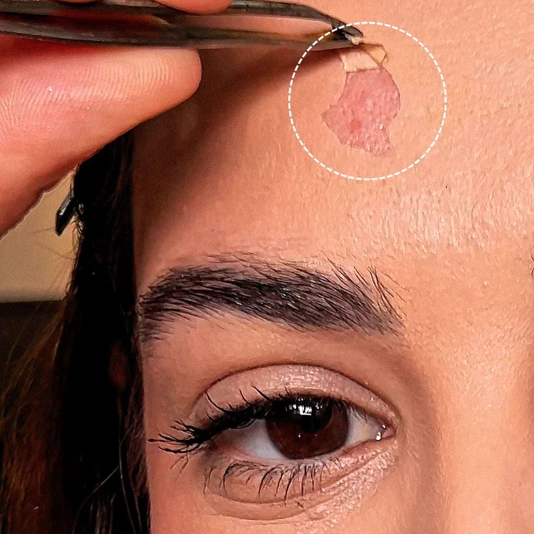 Mão removendo película facial transparente da testa, cuidado com acne adulta, skincare.