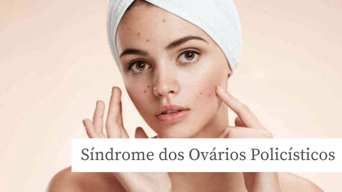 Síndrome dos Ovários Policísticos? Saiba como ela pode afetar sua pele. - PinkPerfect