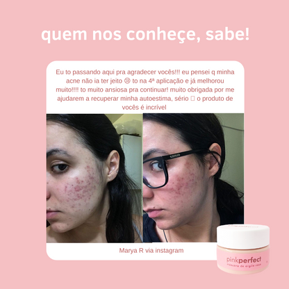 Máscara de Argila Rosa Antiacne + Sérum Vitamina C Ultra Concentrado