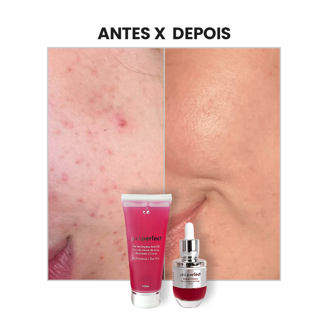 Duo Gel de Limpeza + S-Control