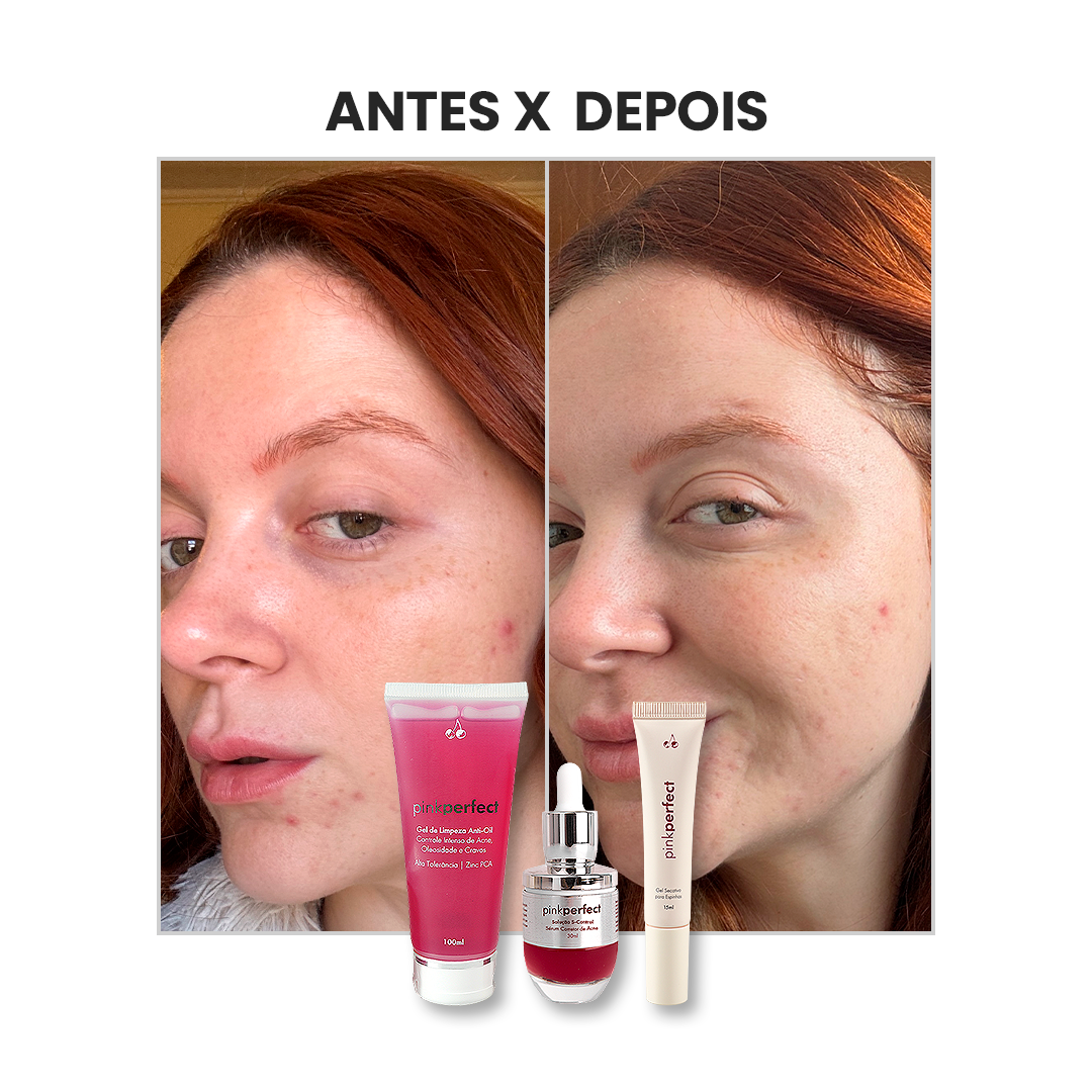 Trio Gel Secativo + Gel de Limpeza + S-Control