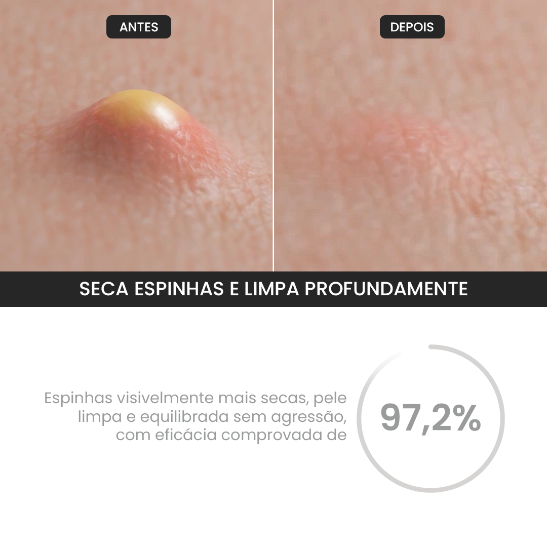 Duo Gel de Limpeza + Gel Secativo