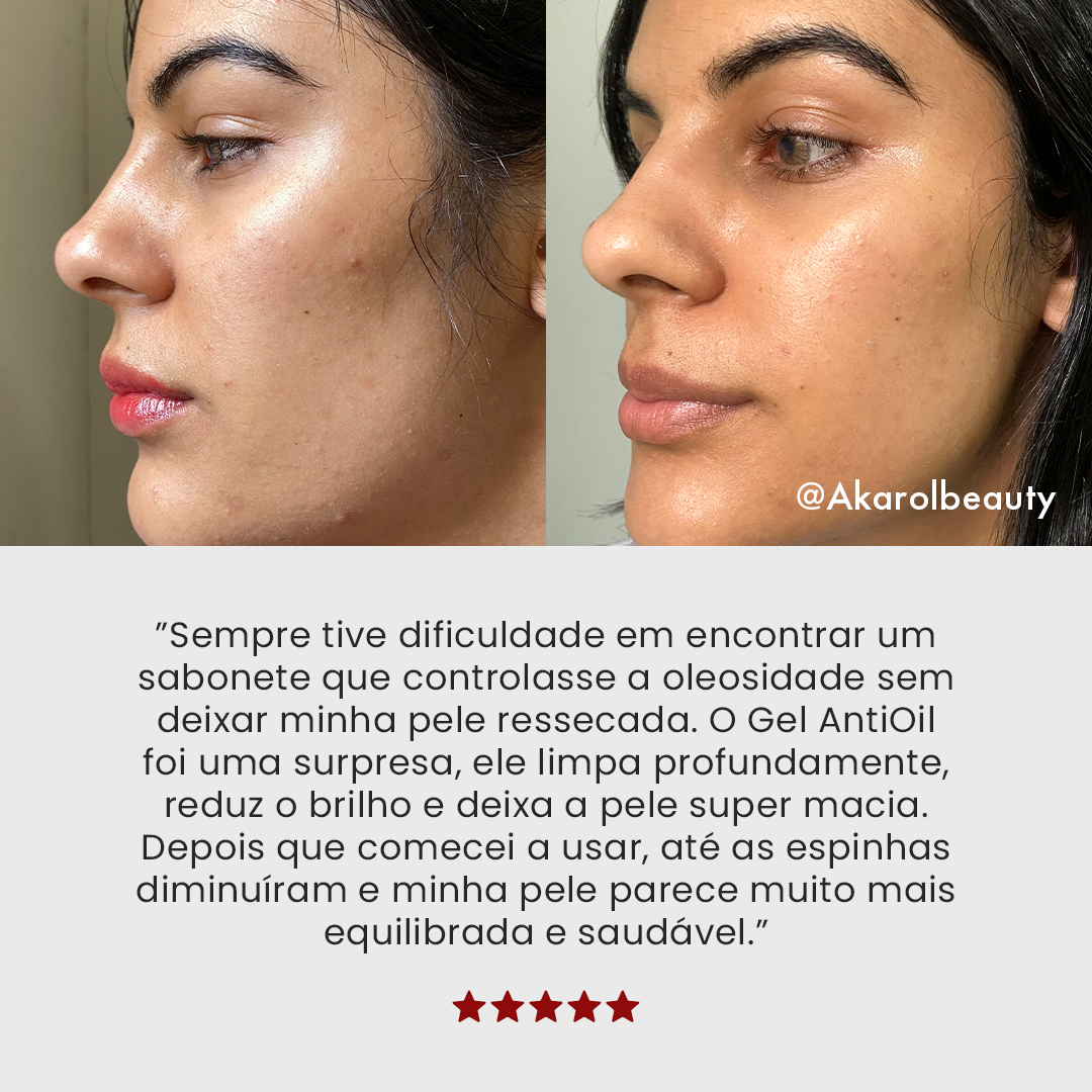 Lançamento: Gel de Limpeza Facial Anti-Oil