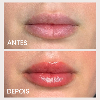 SOS NewLips – Oferta Dia das Mães