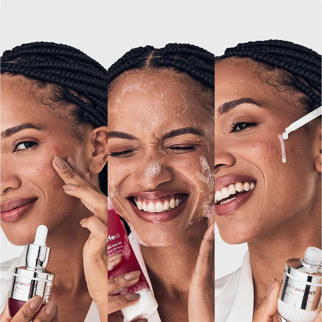 Lançamento: Kit SOS Acne Adulta | Edição Limitada