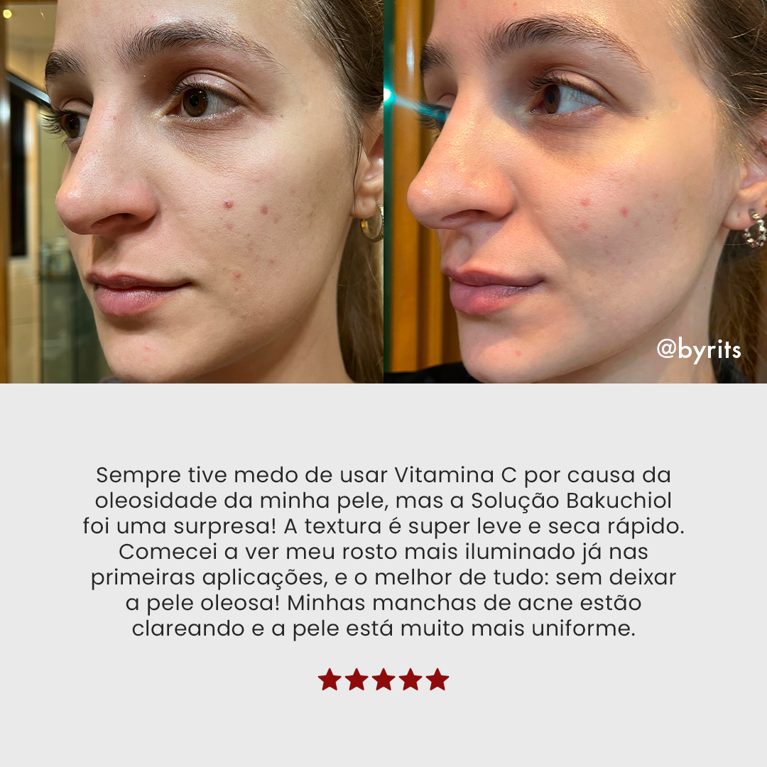Solução Bakuchiol | Sérum de Vitamina C Clareador