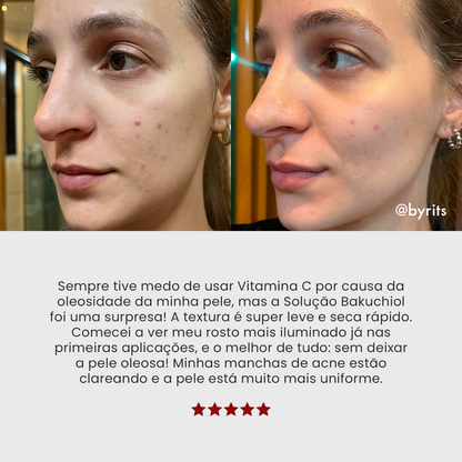 Solução Bakuchiol | Sérum de Vitamina C Clareador
