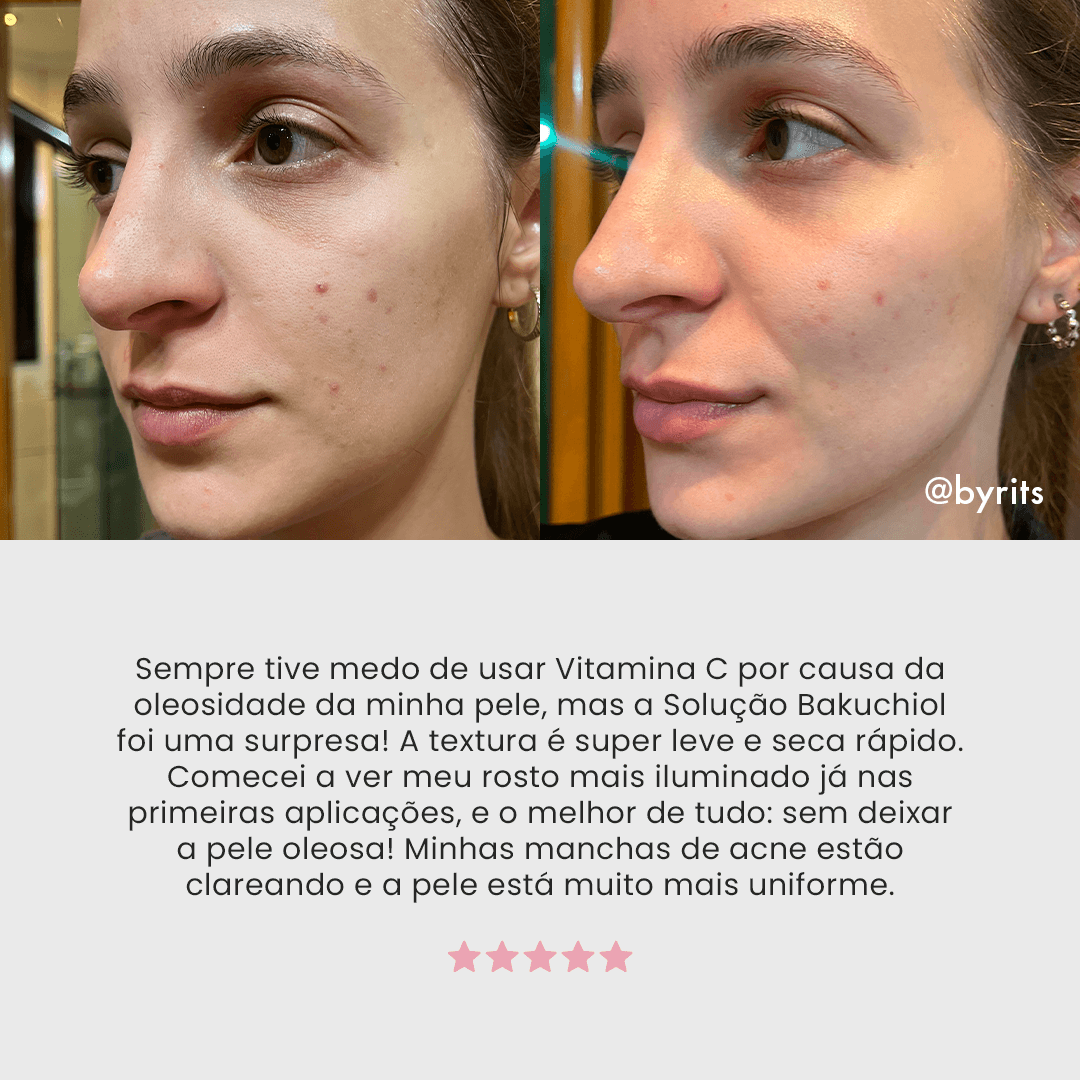 Solução Bakuchiol | Sérum de Vitamina C