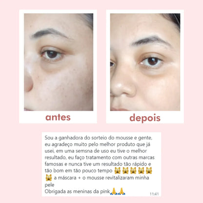 O Último Kit da Pink - 2025 Sem Acne