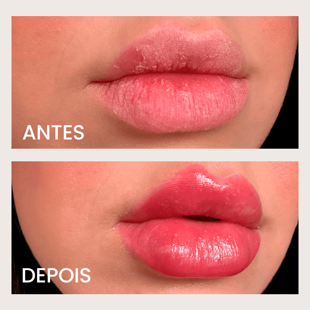 Balm Ultra - Regenerador: Reparação Labial Instantânea + - PinkPerfect