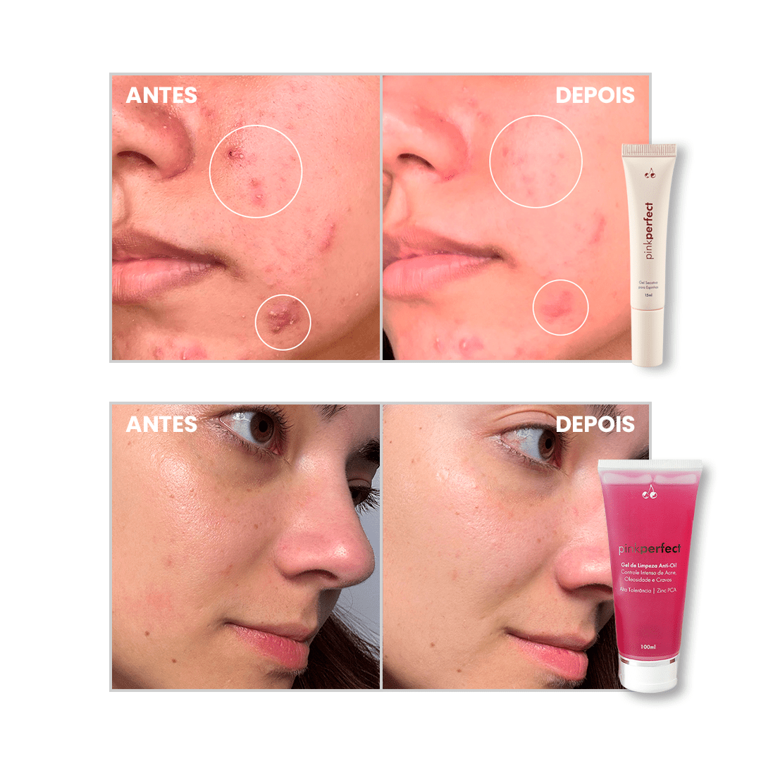 Duo Gel de Limpeza + Gel Secativo - PinkPerfect