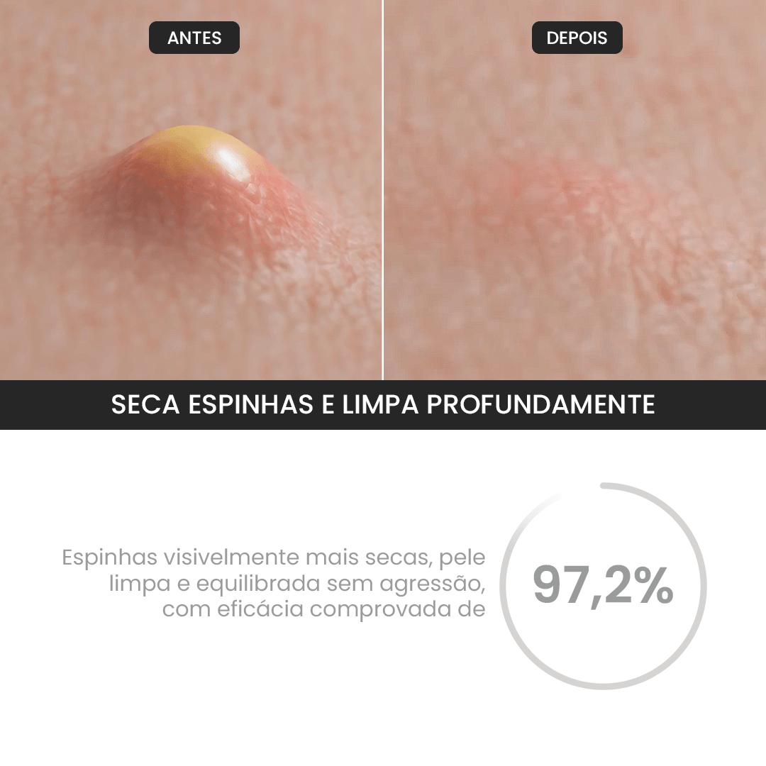 Duo Gel de Limpeza + Gel Secativo - PinkPerfect