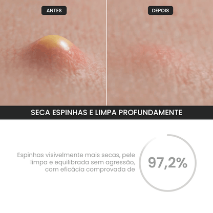 Duo Gel de Limpeza + Gel Secativo - PinkPerfect