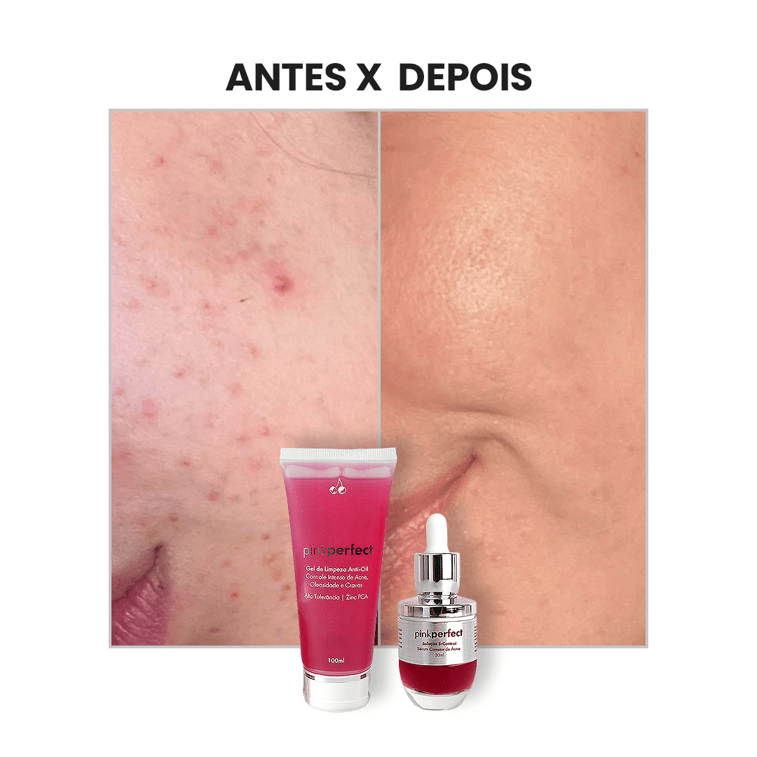 Duo Gel de Limpeza + S - Control - PinkPerfect