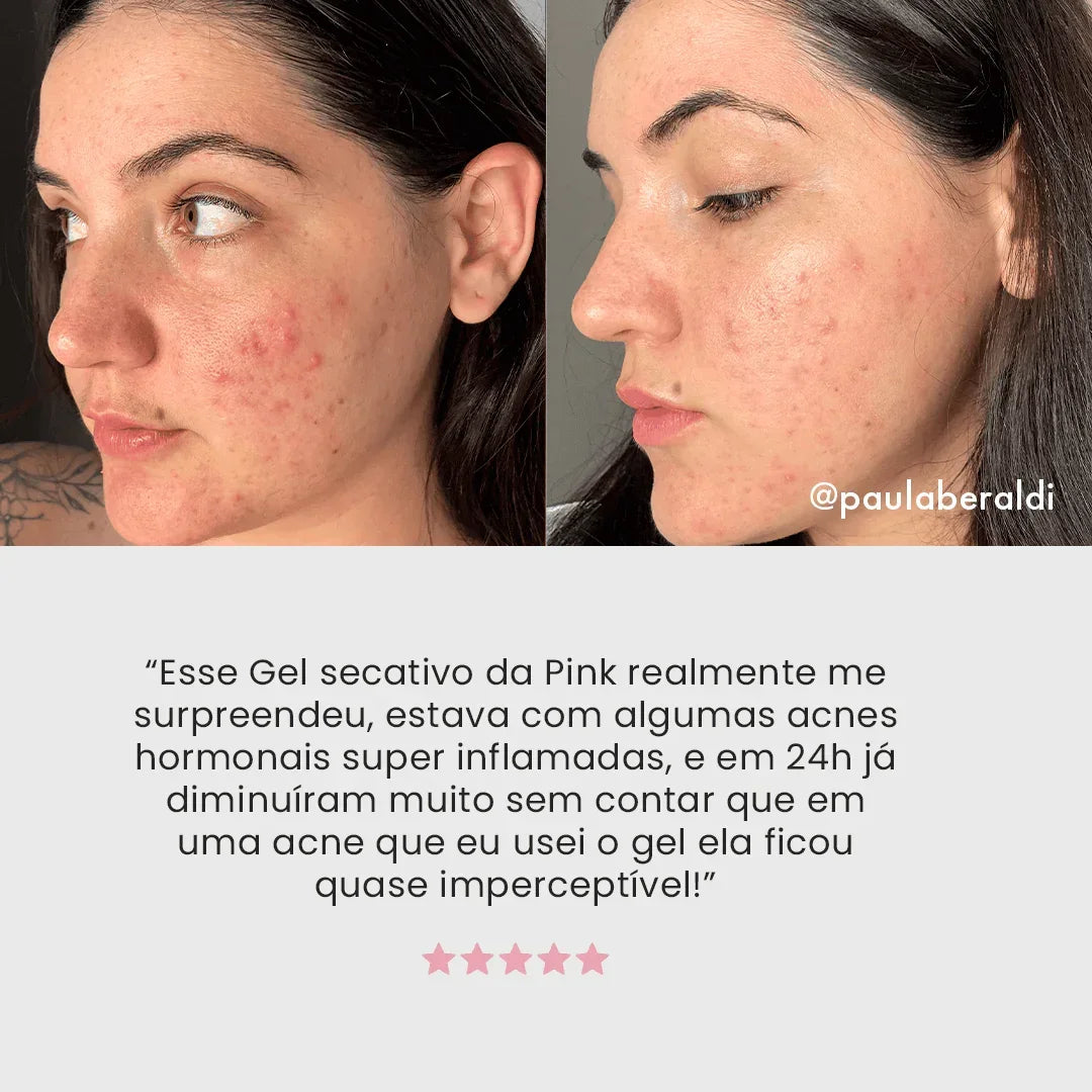 Duo S - Control + Gel Secativo - PinkPerfect