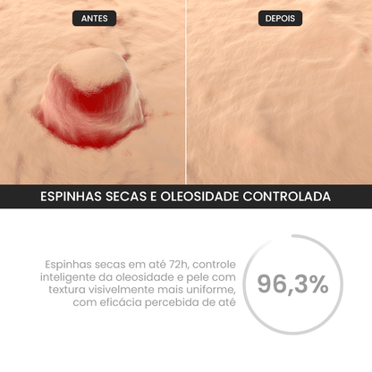 Duo S - Control + Gel Secativo - PinkPerfect