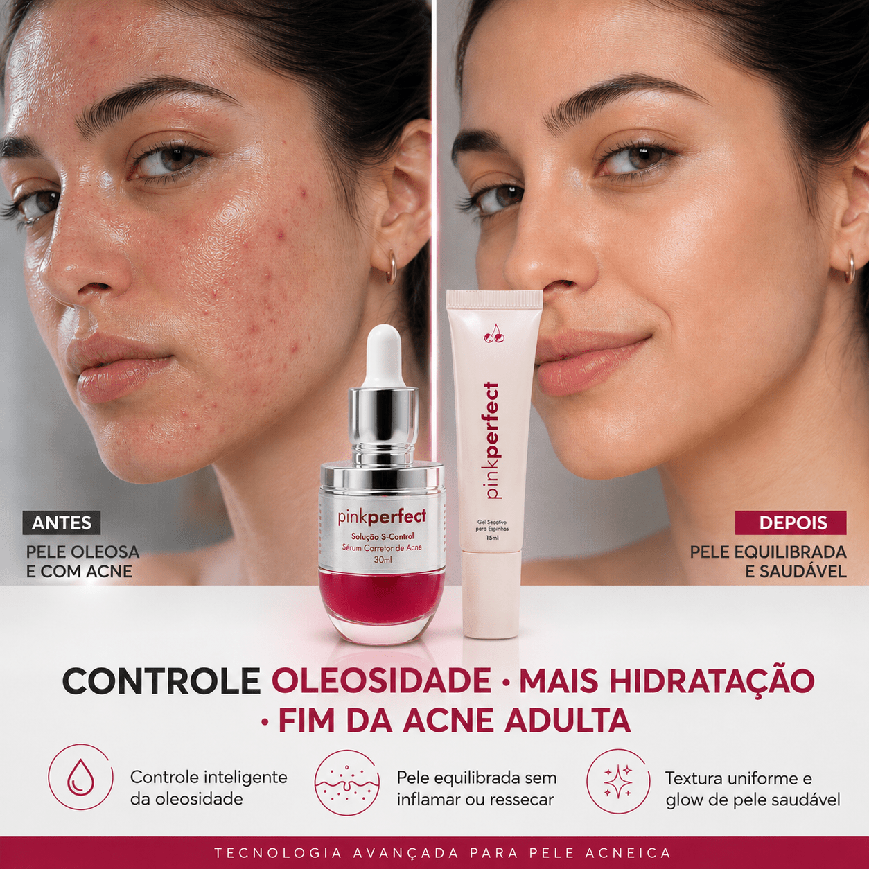 Duo S-Control + Gel Secativo | Edição Limitada - PinkPerfect