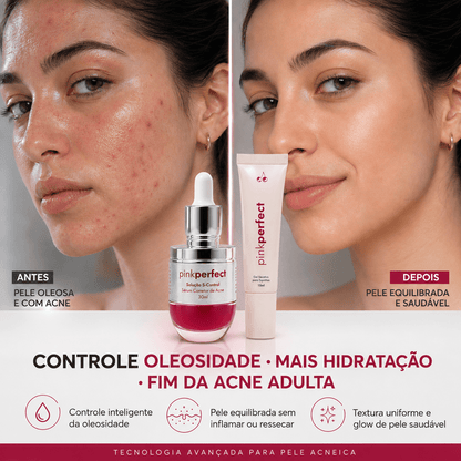 Duo S-Control + Gel Secativo | Edição Limitada - PinkPerfect