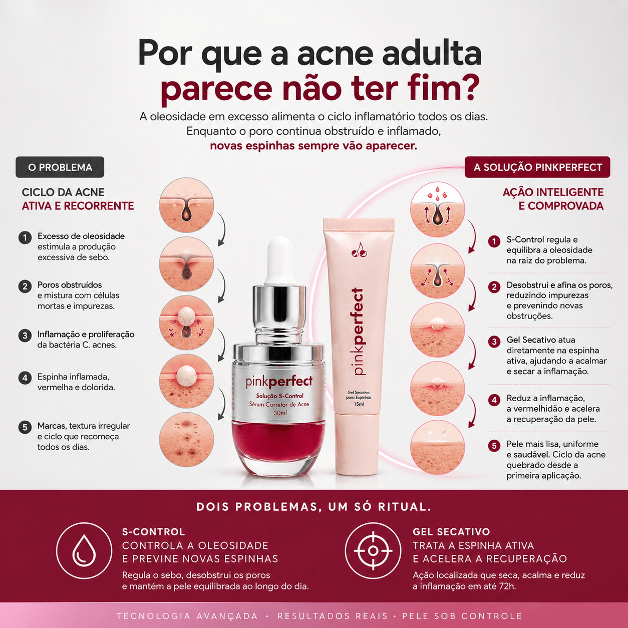 Duo S-Control + Gel Secativo | Edição Limitada - PinkPerfect