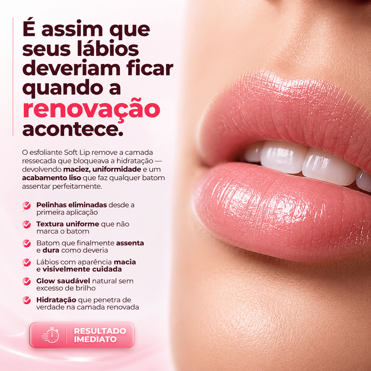 Esfoliante Soft Lip - PinkPerfect