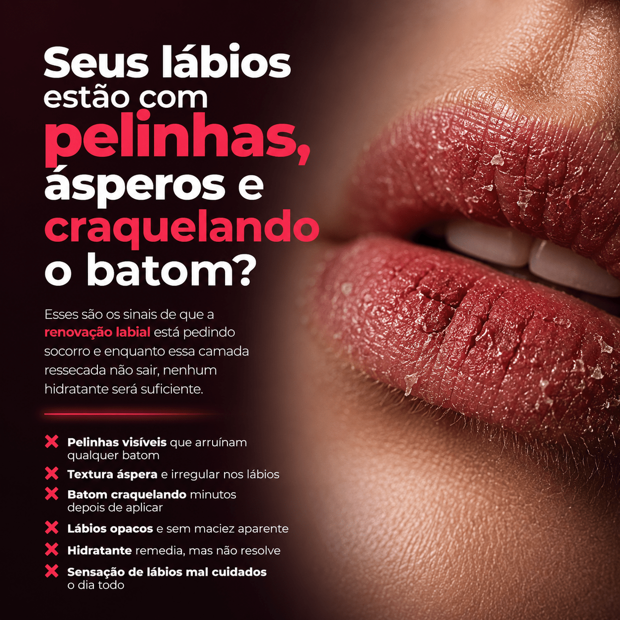 Esfoliante Soft Lip - PinkPerfect