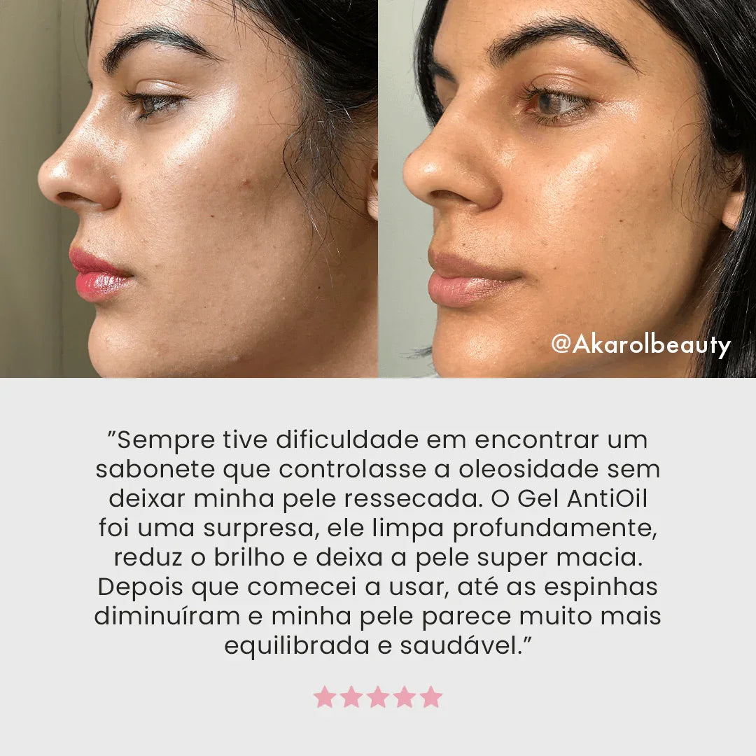 Gel de Limpeza Facial Anti - Oil exclusivo - PinkPerfect