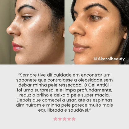 Gel de Limpeza Facial Anti - Oil exclusivo - PinkPerfect