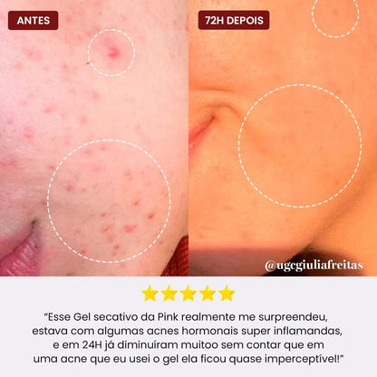 Gel Secativo + Gloss de Brinde - PinkPerfect