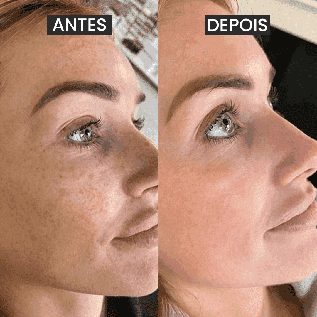 Sérum Facial Antimanchas + - PinkPerfect