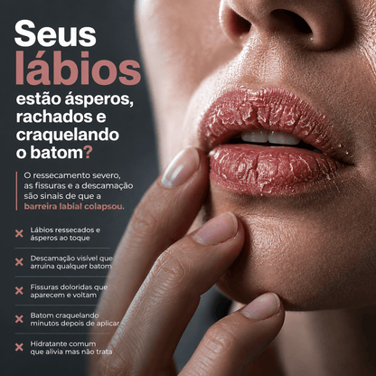 SOS NewLips Cherry | Edição Limitada - PinkPerfect