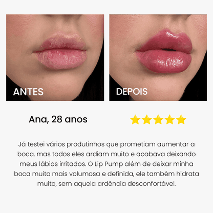 SOS NewLips Coconut - PinkPerfect