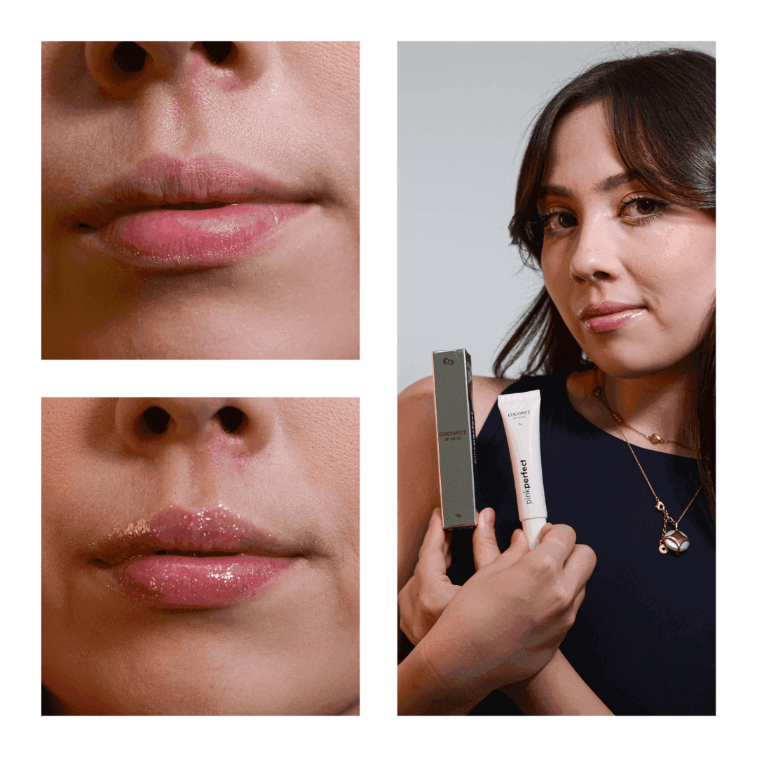 SOS NewLips Completo - PinkPerfect