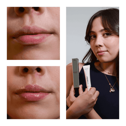 SOS NewLips Completo - PinkPerfect