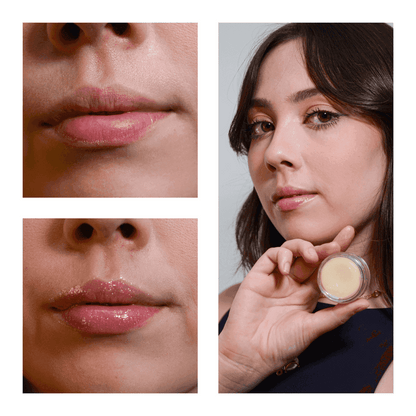 SOS NewLips Completo - PinkPerfect