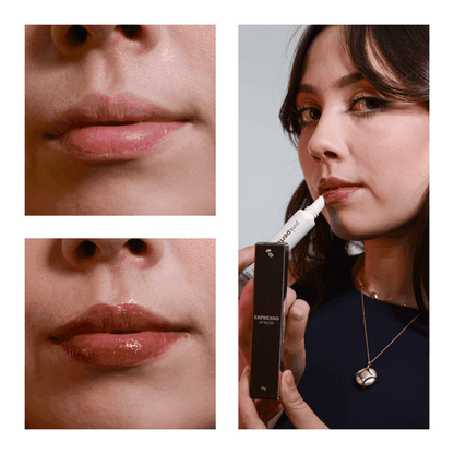 SOS NewLips Completo - PinkPerfect