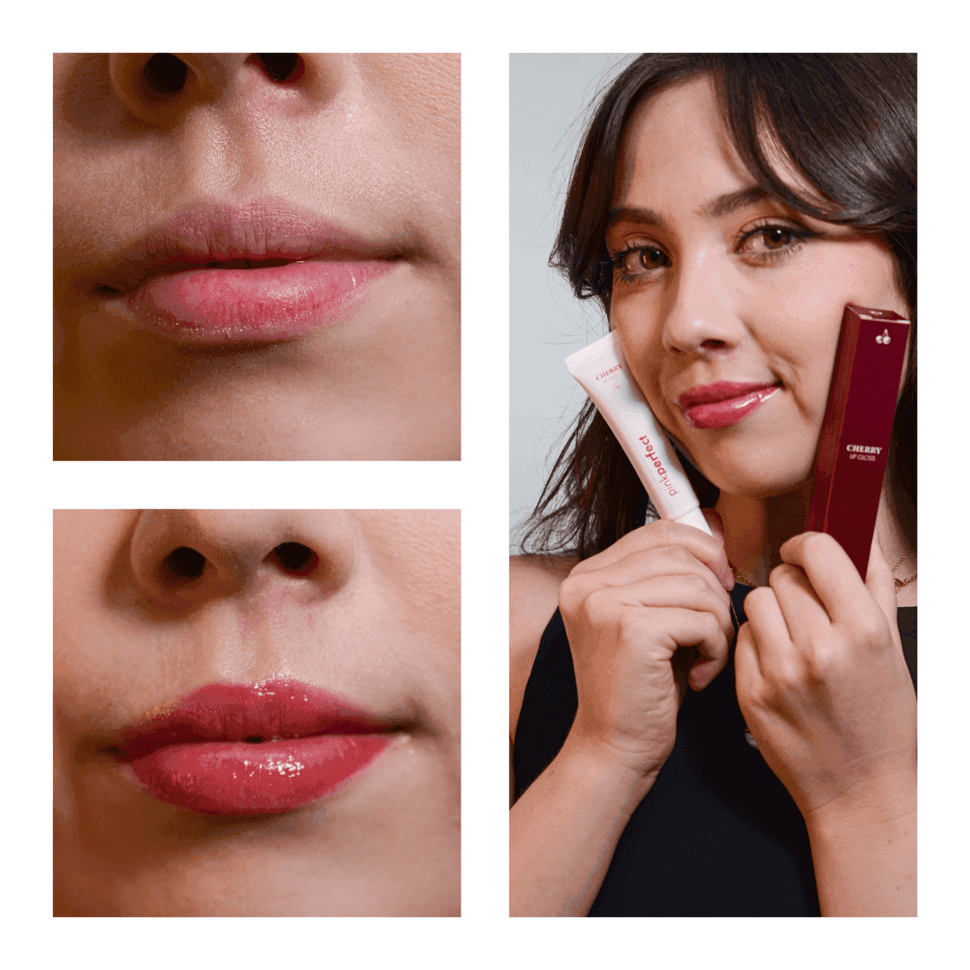 SOS NewLips Completo - PinkPerfect