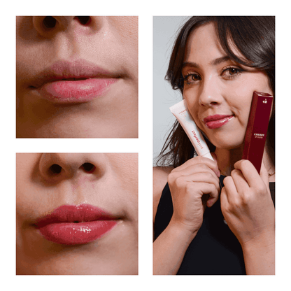 SOS NewLips Completo - PinkPerfect