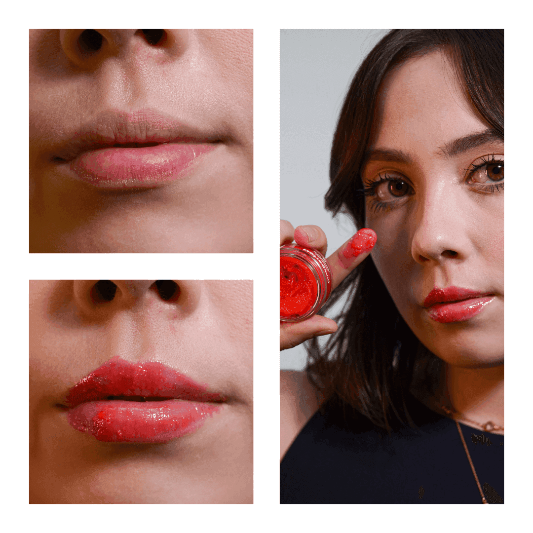 SOS NewLips Completo - PinkPerfect