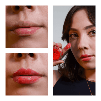 SOS NewLips Completo - PinkPerfect